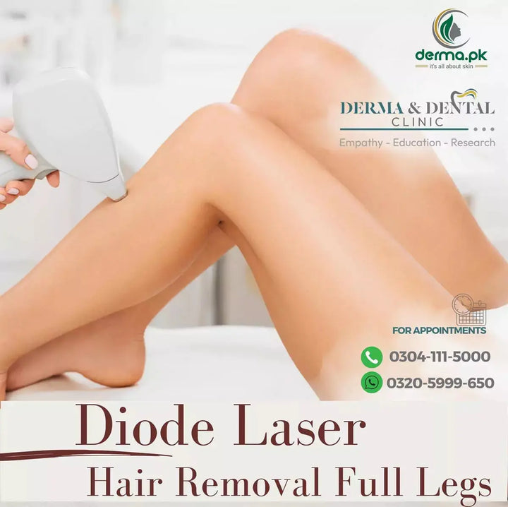 Flawless Full Leg Diode Laser Hair Removal at Derma & Dental Clinic Bahria Town Lahore Derma.pk