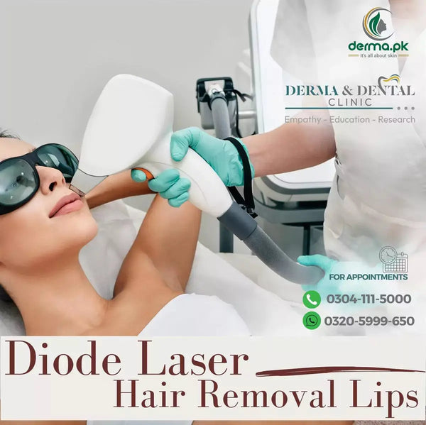 Flawless Lips: Diode Laser Hair Removal for Smooth and Hair-Free Results Derma.pk