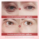 Bioaqua Nicotinamide Eye Cream – 20g | Dark Circles & Fine Line Care photo 6