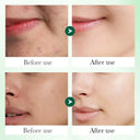 SADOER Salicylic Acid Acne Repair Serum - Niacinamide Face Serum - 40ml photo 5