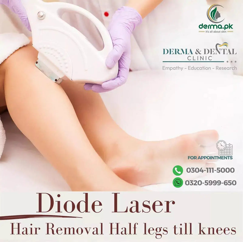 Precision Diode Laser Hair Removal: Half Legs till Knees - Skin Clinic by Dr. Eram Razzaq