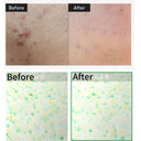 VT Cosmetic Reti-A Reedle Shot 300 50ml photo 4