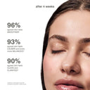 r.hode Glazing Mist Hydrating Face Spray photo 4