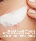 CeraVe Acne Clay To Foam Cleanser photo 2