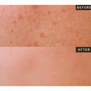 Heveblue Single Vita Dark Spot Pine-Ampoule photo 5