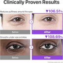 Numbuzin No.9 Nad+ Collagen Under Eye Patches 8g x 5 pairs photo 6