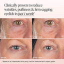 iNNBEAUTY Project Extreme Cream Eye Firming & Contouring Refillable Eye Cream 7ml photo 2