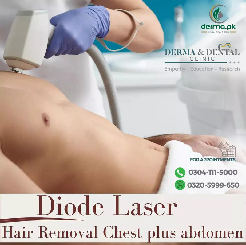 Scientific Diode Laser Hair Removal for Chest and Abdomen at Skin Clinic by Dr. Eram Razzaq