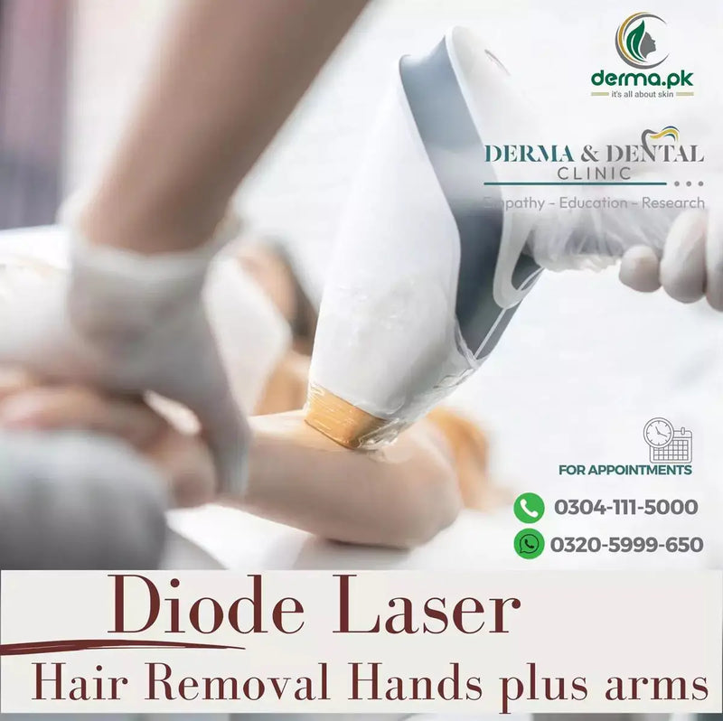 Scientific Diode Laser Hair Removal for Hands and Arms