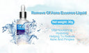BIOAQUA Anti Acne Serum & Cream Set 2pc for Oily Skin photo 6