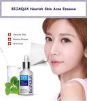 BIOAQUA Anti Acne Serum & Cream Set 2pc for Oily Skin photo 7