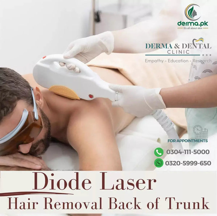 The Science of Diode Laser Hair Removal for Back of Trunk at Derma & Dental Clinic Derma.pk