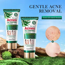 SADOER Tea Tree Acne Oil Control Facial Cleanser 100g photo 5