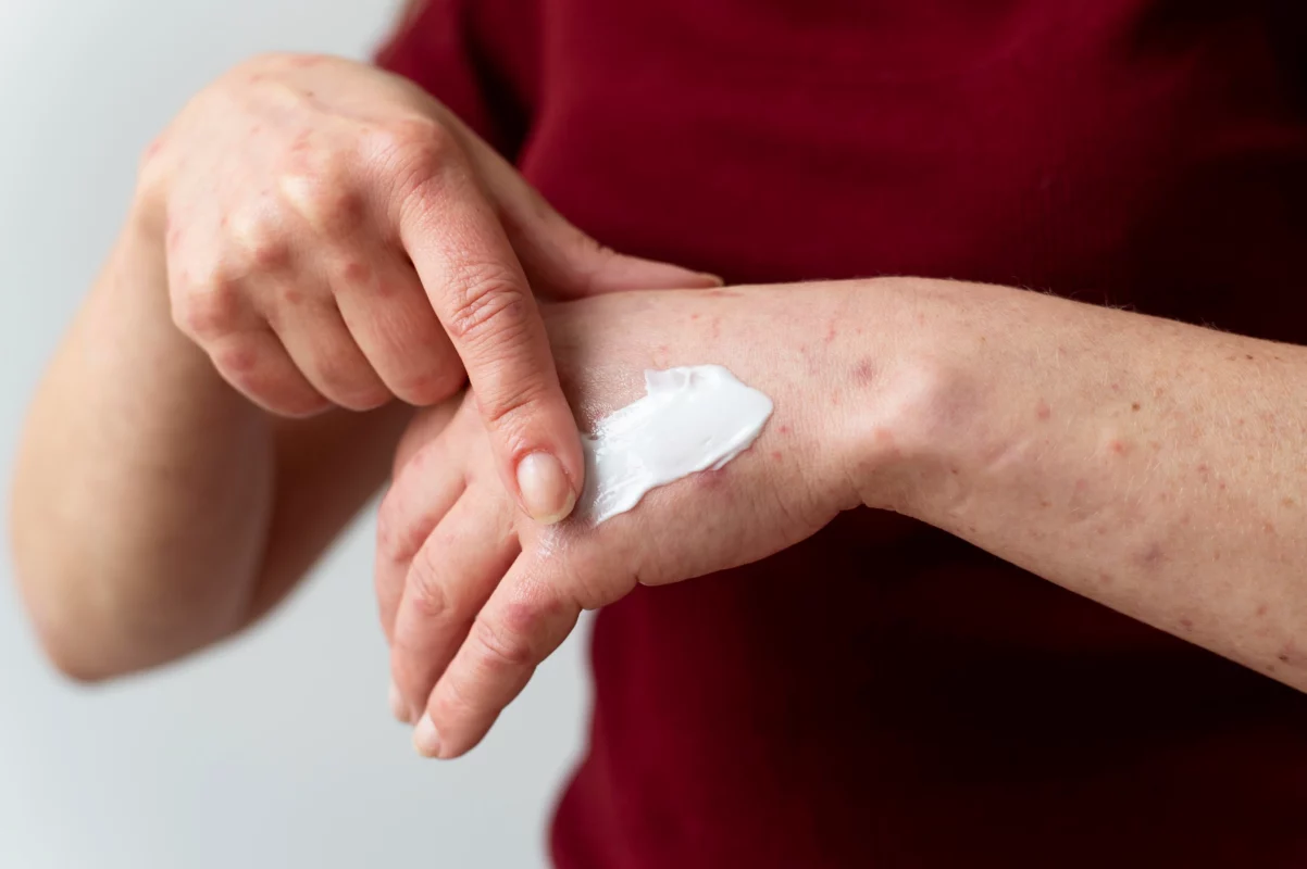 anti fungal cream in pakistan
